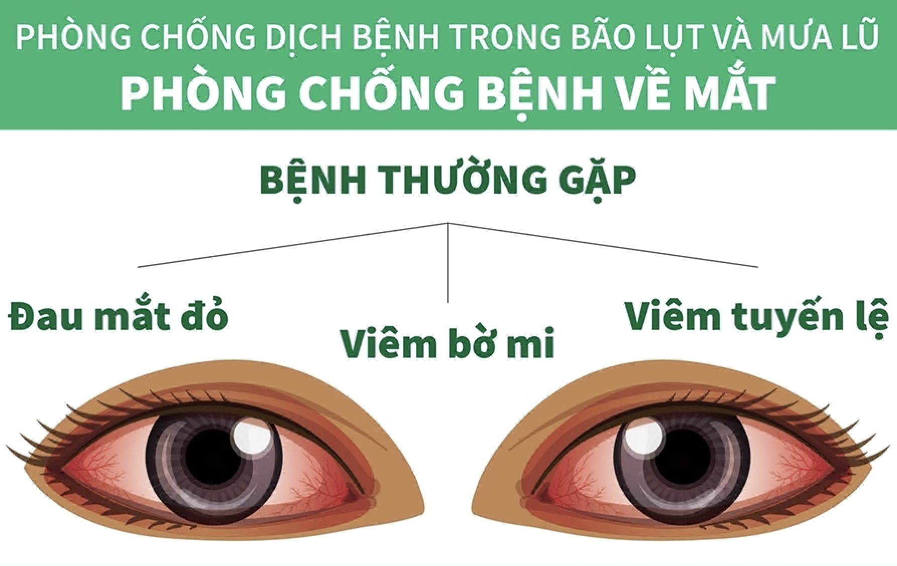 Phòng chống bệnh về mắt mùa bão lụt