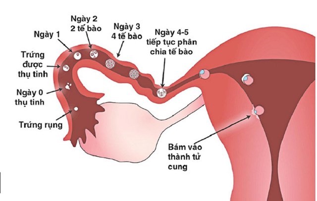 MANG THAI Ở VỊ THÀNH NIÊN - HỆ LỤY KHÔNG THỂ XEM NHẸ