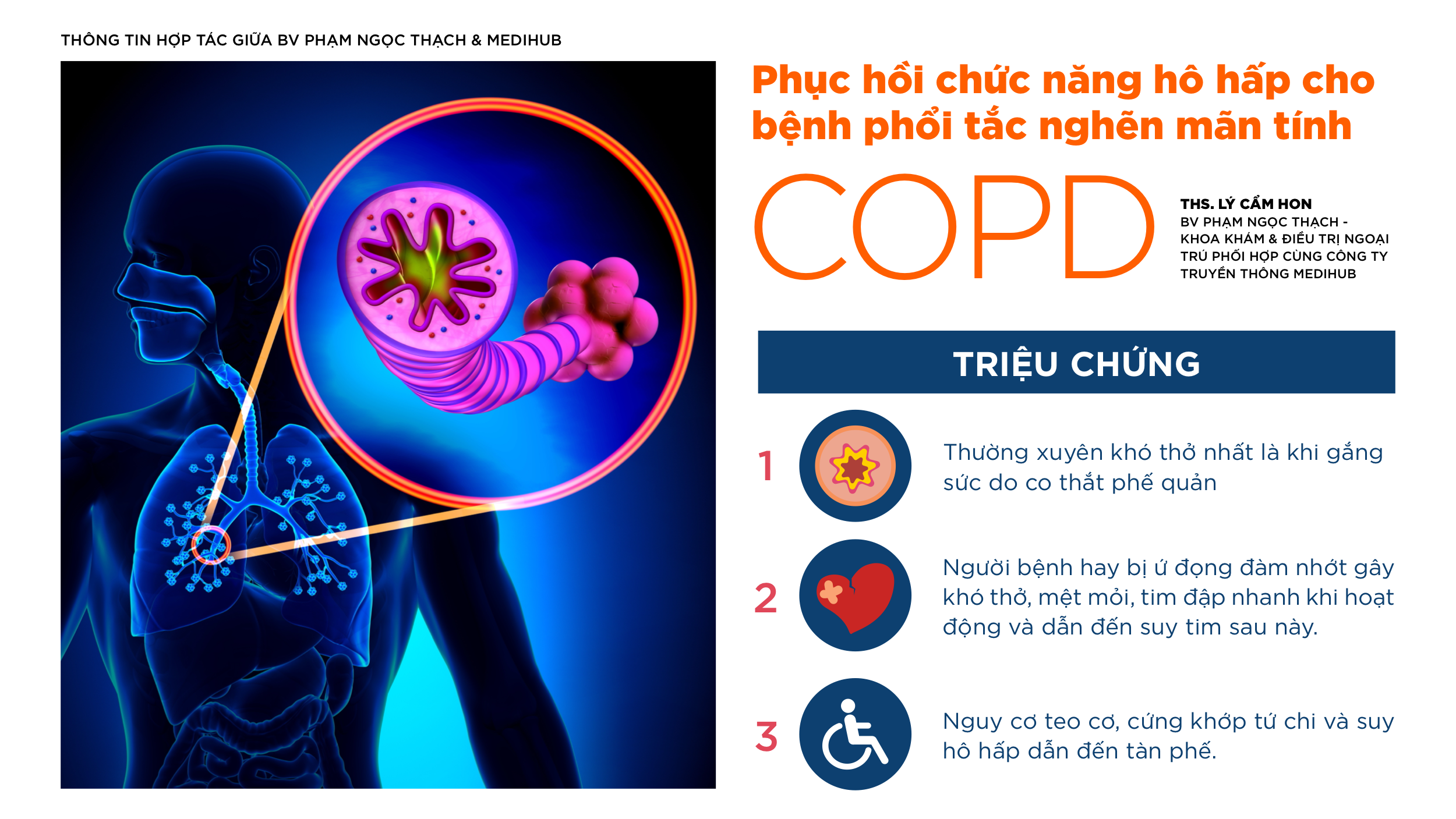 Phục hồi chức năng hô hấp cho bệnh phổi tắc nghẽn mãn tính (COPD)