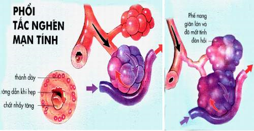 4. Điều trị và quản lý bệnh