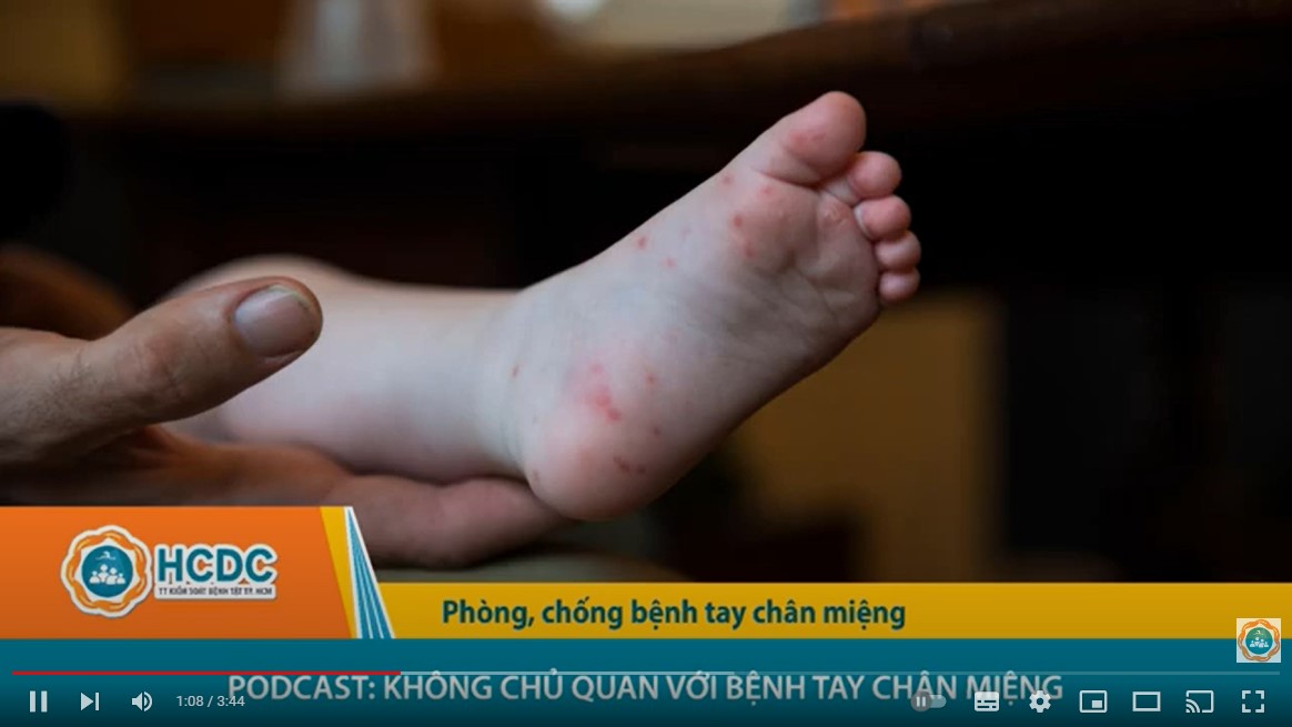 Podcast: Không chủ quan với bệnh tay chân miệng