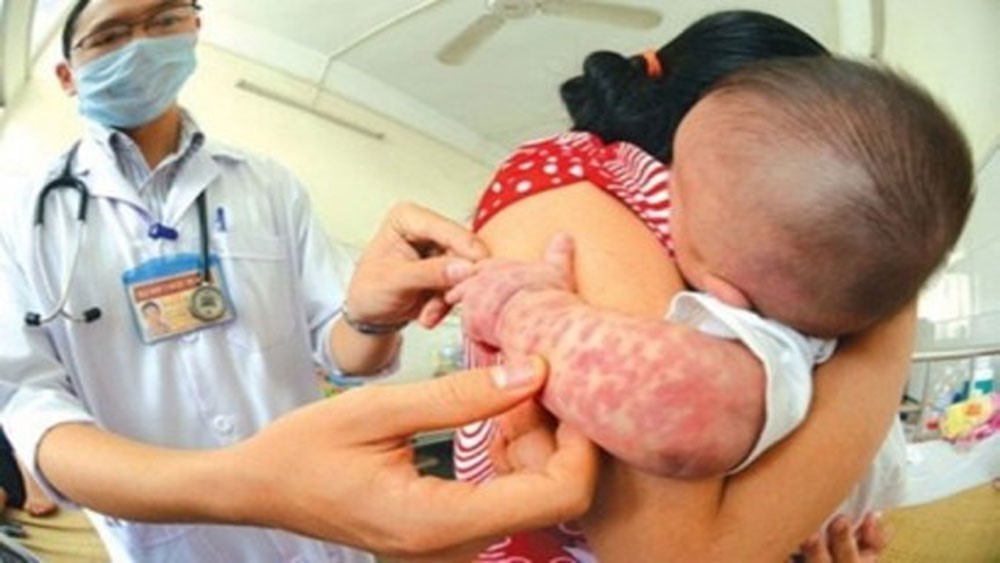 Bệnh truyền nhiễm ở trẻ tăng, kể cả bệnh có vaccine dự phòng: Phải đẩy mạnh tiêm chủng