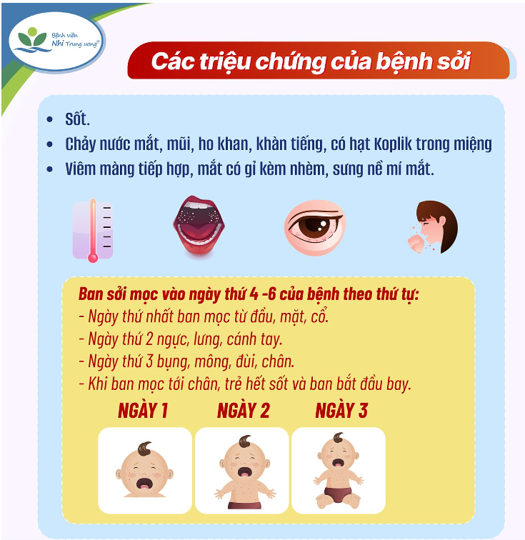 DẤU HIỆU NHẬN BIẾT BỆNH SỞI